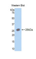 Western Blot; Sample: Recombinant protein.