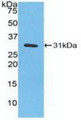 Western Blot; Sample: Recombinant CA3, Human.