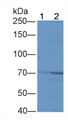 Western Blot; Sample: Lane1: Rat Cerebrum lysate; Lane2: Rat Cerebellum lysate; Primary Ab: 4μg/ml Rabbit Anti-Human MPP3 Antibody; Second Ab: 0.2µg/mL HRP-Linked Caprine Anti-Rabbit IgG Polyclonal Antibody;