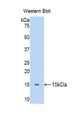 Western Blot; Sample: Recombinant protein.