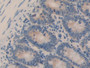 DAB staining on IHC-P; Samples: Rat Small intestine Tissue; Primary Ab: 20µg/ml Rabbit Anti-Rat HSPA8 Antibody Second Ab: 2µg/mL HRP-Linked Caprine Anti-Rabbit IgG Polyclonal Antibody