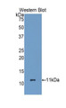 Western Blot; Sample: Recombinant protein.