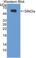 Western Blot; Sample: Recombinant protein.