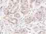 DAB staining on IHC-P; Samples: Human Stomach Tissue.