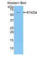 Western Blot; Sample: Recombinant protein.