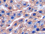 DAB staining on IHC-P; Samples: Rat Liver Tissue; Primary Ab: 20µg/ml Rabbit Anti-Rat FTH Antibody Second Ab: 2µg/mL HRP-Linked Caprine Anti-Rabbit IgG Polyclonal Antibody