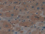 DAB staining on IHC-P; Samples: Human Liver Tissue; Primary Ab: 10µg/ml Rabbit Anti-Human FTH Antibody Second Ab: 2µg/mL HRP-Linked Caprine Anti-Rabbit IgG Polyclonal Antibody