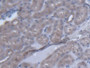 DAB staining on fromalin fixed paraffin- embedded stomach tissue)