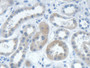DAB staining on IHC-P; Samples: Human Kidney Tissue; Primary Ab: 20µg/ml Rabbit Anti-Human IARS Antibody Second Ab: 2µg/mL HRP-Linked Caprine Anti-Rabbit IgG Polyclonal Antibody