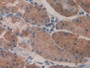 DAB staining on IHC-P; Samples: Human Stomach Tissue