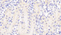 DAB staining on IHC-P; Samples: Mouse Kidney Tissue; Primary Ab: 20μg/ml Rabbit Anti-Mouse FARS2 Antibody Second Ab: 2µg/mL HRP-Linked Caprine Anti-Rabbit IgG Polyclonal Antibody
