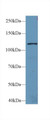 Western Blot; Sample: Mouse Liver lysate; Primary Ab: 2µg/ml Rabbit Anti-Human LARS Antibody Second Ab: 0.2µg/mL HRP-Linked Caprine Anti-Rabbit IgG Polyclonal Antibody