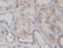 DAB staining on IHC-P; Samples: Human Kidney Tissue; Primary Ab: 20µg/ml Rabbit Anti-Human RARS Antibody Second Ab: 2µg/mL HRP-Linked Caprine Anti-Rabbit IgG Polyclonal Antibody