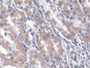 DAB staining on IHC-P; Samples: Human Stomach Tissue; Primary Ab: 20µg/ml Rabbit Anti-Human NARS Antibody Second Ab: 2µg/mL HRP-Linked Caprine Anti-Rabbit IgG Polyclonal Antibody