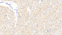DAB staining on IHC-P; Samples: Human Cardiac Muscle Tissue; Primary Ab: 20μg/ml Rabbit Anti-Human PARP4 Antibody Second Ab: 2µg/mL HRP-Linked Caprine Anti-Rabbit IgG Polyclonal Antibody
