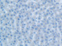 DAB staining on IHC-P; Samples: Rat Liver Tissue; Primary Ab: 20µg/ml Rabbit Anti-Rat CEACAM1 Antibody Second Ab: 2µg/mL HRP-Linked Caprine Anti-Rabbit IgG Polyclonal Antibody