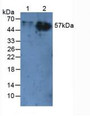 Western Blot; Sample: Lane1: Rat Liver Tissue; Lane2: Rat Skin Tissue.