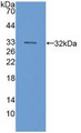 Western Blot; Sample: Recombinant C6, Human.