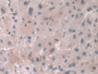 DAB staining on IHC-P; Samples: Human Liver Tissue; Primary Ab: 10µg/ml Rabbit Anti-Human CTSZ Antibody Second Ab: 2µg/mL HRP-Linked Caprine Anti-Rabbit IgG Polyclonal Antibody