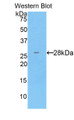 Western Blot; Sample: Recombinant protein.