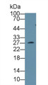 Western Blot; Sample: Mouse Serum; &lt;br/&gt;Primary Ab: 1µg/ml Rabbit Anti-Mouse CLTA Antibody&lt;br/&gt;Second Ab: 0.2µg/mL HRP-Linked Caprine Anti-Rabbit IgG Polyclonal Antibody&lt;br/&gt;