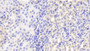 DAB staining on IHC-P; Samples: Mouse Kidney Tissue;  Primary Ab: 20μg/ml Rabbit Anti-Mouse CLTA Antibody Second Ab: 2µg/mL HRP-Linked Caprine Anti-Rabbit IgG Polyclonal Antibody 