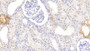 DAB staining on IHC-P; Samples: Human Kidney Tissue;  Primary Ab: 20µg/ml Rabbit Anti-Human MTNR1A Antibody Second Ab: 2µg/mL HRP-Linked Caprine Anti-Rabbit IgG Polyclonal Antibody 