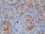 DAB staining on IHC-P; Samples: Human Kidney Tissue; Primary Ab: 10µg/ml Rabbit Anti-Human CRYaB Antibody Second Ab: 2µg/mL HRP-Linked Caprine Anti-Rabbit IgG Polyclonal Antibody
