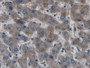 DAB staining on IHC-P; Samples: Human Liver Tissue;  Primary Ab: 20µg/ml Rabbit Anti-Human gABBR1 An