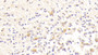 DAB staining on IHC-P; Samples: Human Cerebrum Tissue;  Primary Ab: 20μg/ml Rabbit Anti-Human PDGFB Antibody Second Ab: 2µg/mL HRP-Linked Caprine Anti-Rabbit IgG Polyclonal Antibody 