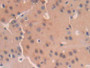 DAB staining on fromalin fixed paraffin-embedded Liver tissue)