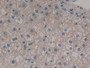 DAB staining on IHC-P; Samples: Human Liver Tissue; Primary Ab: 30µg/ml Rabbit Anti-Human FGF12 Antibody Second Ab: 2µg/mL HRP-Linked Caprine Anti-Rabbit IgG Polyclonal Antibody