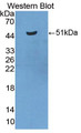 Western Blot; Sample: Recombinant protein.