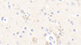DAB staining on IHC-P; Samples: Human Cerebrum Tissue; Primary Ab: 20μg/ml Rabbit Anti-Human RTN1 Antibody Second Ab: 2µg/mL HRP-Linked Caprine Anti-Rabbit IgG Polyclonal Antibody
