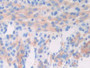 DAB staining on IHC-P; Samples: Mouse Uterus Tissue; Primary Ab: 20µg/ml Rabbit Anti-Mouse GAD1 Antibody Second Ab: 2µg/mL HRP-Linked Caprine Anti-Rabbit IgG Polyclonal Antibody