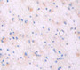 Dermcidin (Dcd) Polyclonal Antibody, Cat#CAU23766