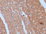 DAB staining on fromalin fixed paraffin-embedded Kidney tissue)