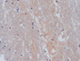 DAB staining on IHC-P; Samples: Human Cerebrum Tissue;  Primary Ab: 10µg/ml Rabbit Anti-Human SERT A