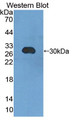 Western Blot; Sample: Recombinant protein.