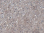 DAB staining on IHC-P; Samples: Human Liver Tissue