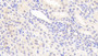 DAB staining on IHC-P; Samples: Human Kidney Tissue;  Primary Ab: 20μg/ml Rabbit Anti-Human SOST Antibody Second Ab: 2µg/mL HRP-Linked Caprine Anti-Rabbit IgG Polyclonal Antibody 