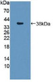 Western Blot; Sample: Recombinant SNTb1, Mouse.