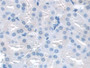 DAB staining on IHC-P; Samples: Mouse Kidney Tissue; Primary Ab: 20µg/ml Rabbit Anti-Mouse SNAP23 Antibody Second Ab: 2µg/mL HRP-Linked Caprine Anti-Rabbit IgG Polyclonal Antibody