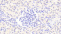 DAB staining on IHC-P; Samples: Human Kidney Tissue;  Primary Ab: 20μg/ml Rabbit Anti-Human RNLS Antibody Second Ab: 2µg/mL HRP-Linked Caprine Anti-Rabbit IgG Polyclonal Antibody 