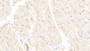 DAB staining on IHC-P; Samples: Human Cardiac Muscle Tissue; Primary Ab: 20μg/ml Rabbit Anti-Human ST1 Antibody Second Ab: 2µg/mL HRP-Linked Caprine Anti-Rabbit IgG Polyclonal Antibody