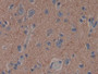 DAB staining on IHC-P; Samples: Human Cerebrum Tissue; Primary Ab: 30µg/ml Rabbit Anti-Human CAP2 Antibody Second Ab: 2µg/mL HRP-Linked Caprine Anti-Rabbit IgG Polyclonal Antibody