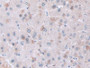 DAB staining on IHC-P; Samples: Human Liver Tissue; Primary Ab: 30µg/ml Rabbit Anti-Human CAP2 Antibody Second Ab: 2µg/mL HRP-Linked Caprine Anti-Rabbit IgG Polyclonal Antibody