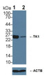 Knockout Varification: &lt;br/&gt;Lane 1: Wild-type 293T cell lysate; &lt;br/&gt;Lane 2: TK1 knockout 293T cell lysate; &lt;br/&gt;Predicted MW: 25kDaa &lt;br/&gt;Observed MW: 26kDa&lt;br/&gt;Primary Ab: 3µg/ml Rabbit Anti-Human TK1 Antibody&lt;br/&gt;Second Ab: 0.2µg/mL HRP-Linked Caprine Anti-Rabbit IgG Polyclonal Antibody&lt;br/&gt;