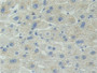 DAB staining on IHC-P; Samples: Human Liver Tissue