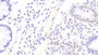 DAB staining on IHC-P; Samples: Human Colon Tissue; Primary Ab: 20μg/ml Rabbit Anti-Human TREX1 Antibody Second Ab: 2µg/mL HRP-Linked Caprine Anti-Rabbit IgG Polyclonal Antibody